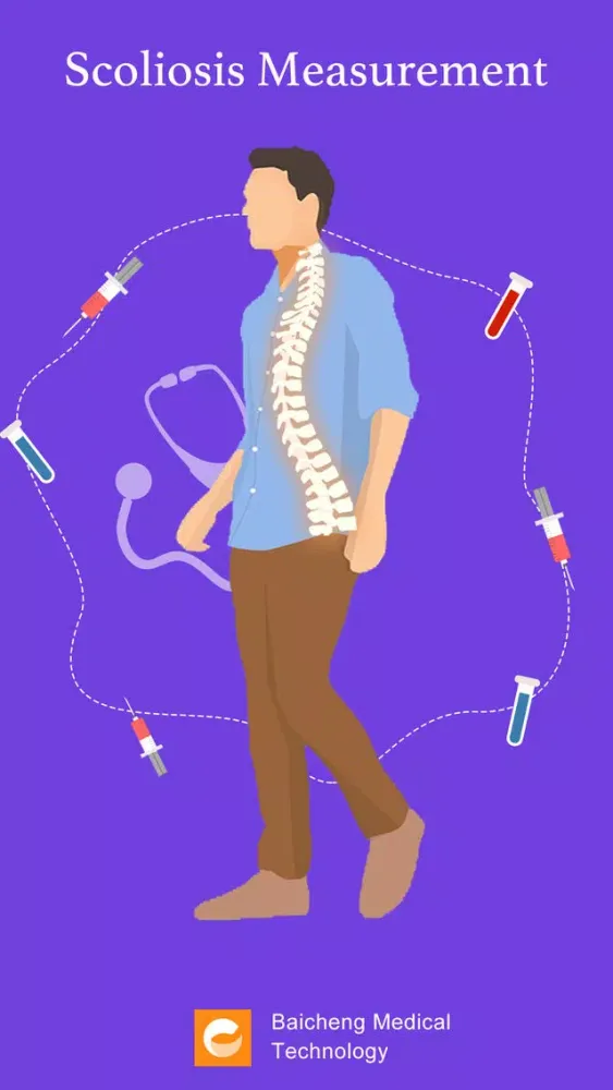 Scoliosis Measurement スクリーンショット
