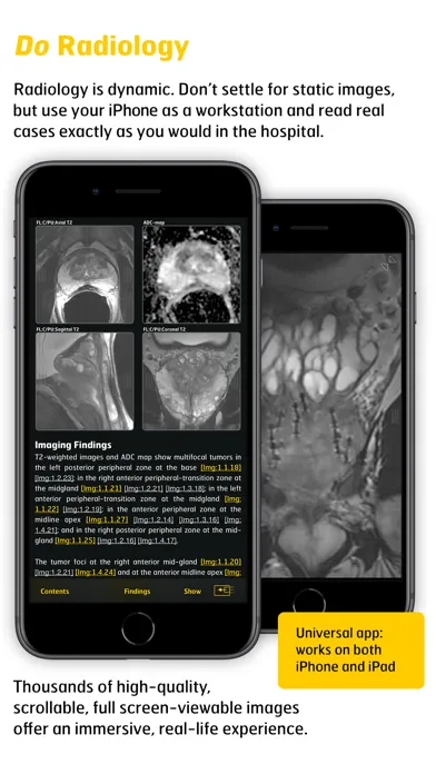 MR Imaging in Prostate Cancer سکرین شاٹس