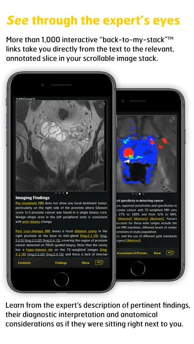 MR Imaging in Prostate Cancer سکرین شاٹس