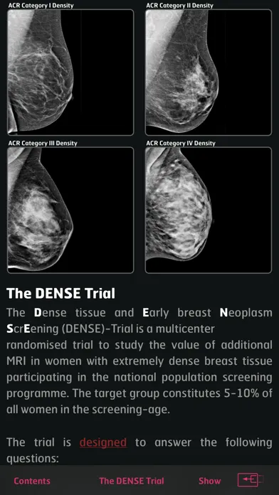 Tangkapan skrin DENSE Trial