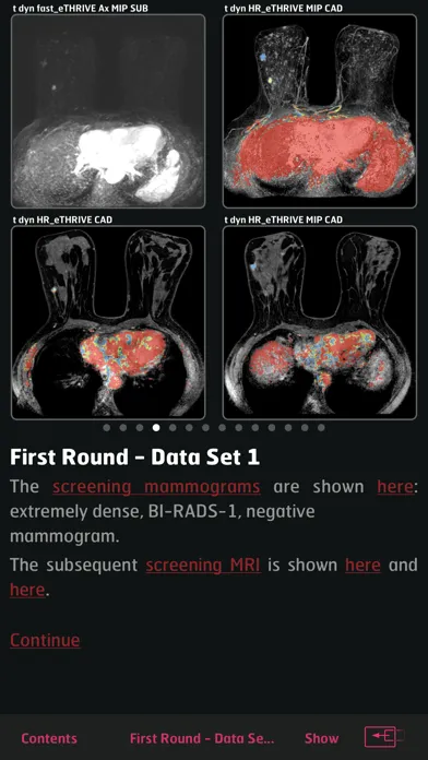 Tangkapan skrin DENSE Trial