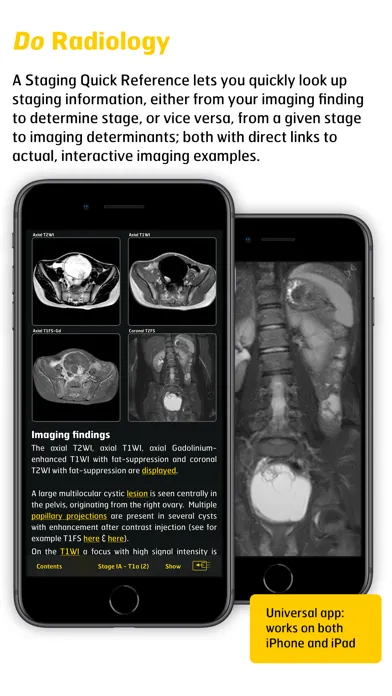 Gyn Cancer Staging Atlas应用截图