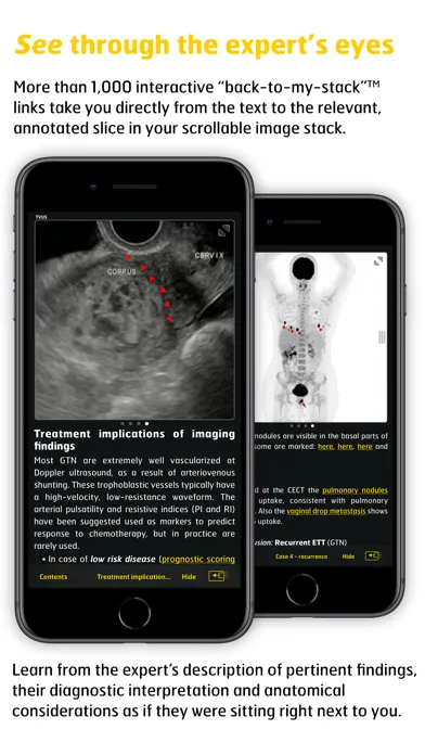 Gyn Cancer Staging Atlas应用截图