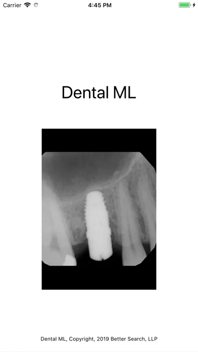 ภาพหน้าจอของ Dental ML