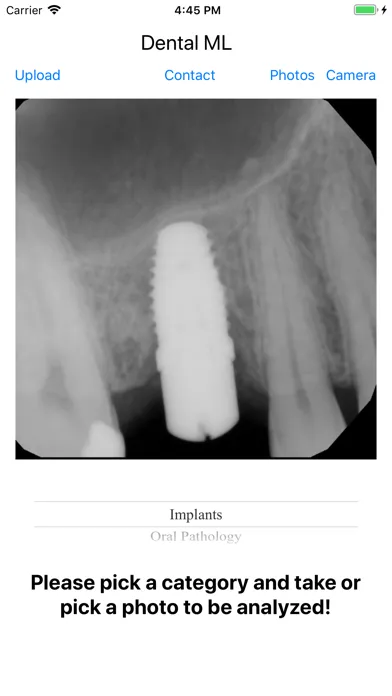 ภาพหน้าจอของ Dental ML