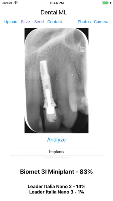 ภาพหน้าจอของ Dental ML