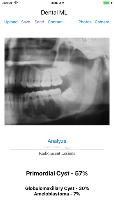 ภาพหน้าจอของ Dental ML