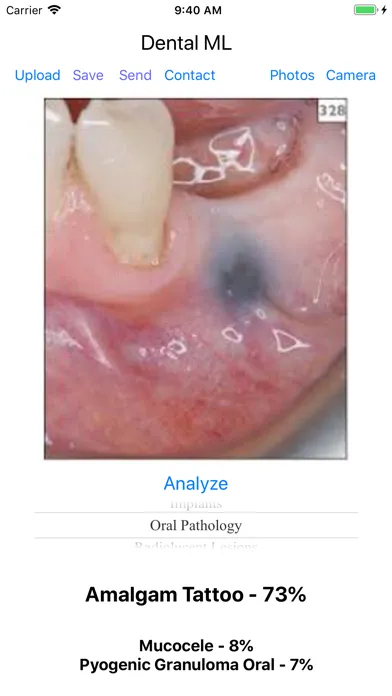 ภาพหน้าจอของ Dental ML