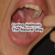 Curing Halitosisthe Natural Way