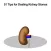 51 Tips for Dealing Kidney Stones