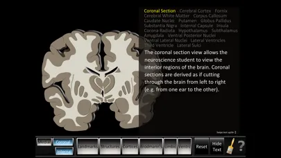 Cerebrum ID Screenshots