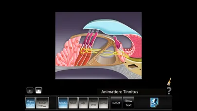 Ear Disorders: Inner Screenshots