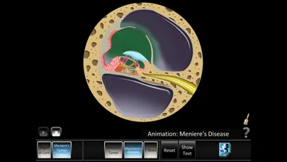 Ear Disorders: Inner Screenshots