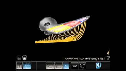 Ear Disorders: Inner Screenshots