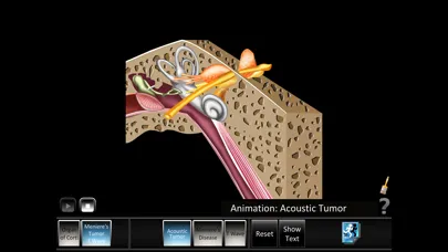 Ear Disorders: Inner Screenshots