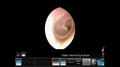Ear Disorders: Inner Screenshots
