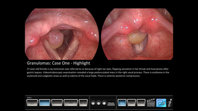 Скриншоты Vocal Pathology: Reflux