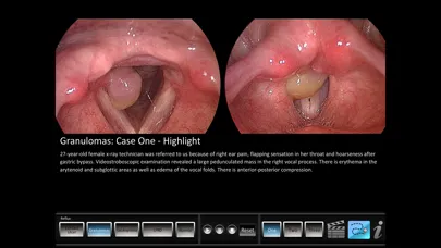 Vocal Pathology: Reflux应用截图