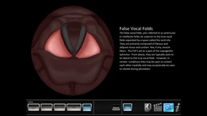Vocal Pathology: Reflux应用截图