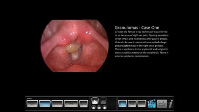 Vocal Pathology: Reflux应用截图