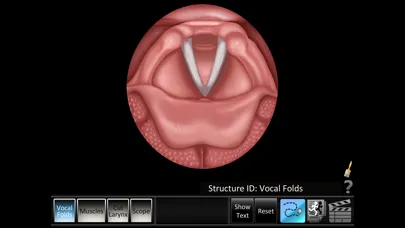 Vocal Folds ID应用截图
