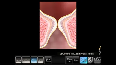 Vocal Folds ID应用截图