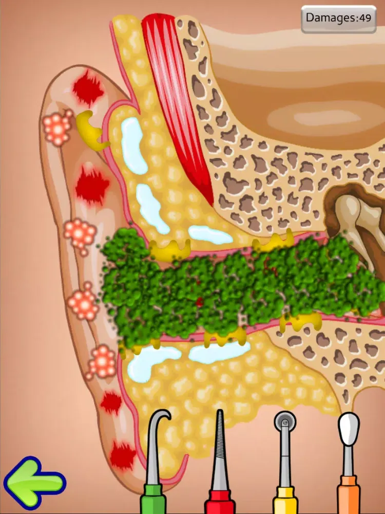 Tangkapan layar Ear Doctor Clinic - For Kids iPad 