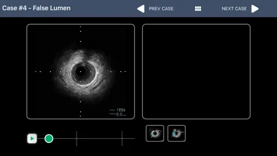 Скриншоты IVUS + Physiology Pro