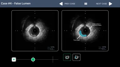 Скриншоты IVUS + Physiology Pro