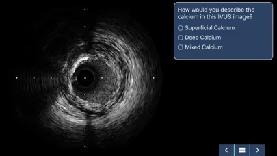 Скриншоты IVUS + Physiology Pro