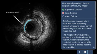 Скриншоты IVUS + Physiology Pro