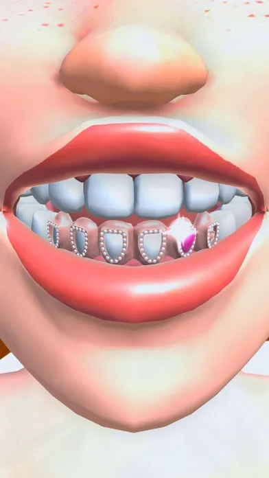 Zrzuty ekranu Grillz DIY