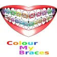 Colour My Braces
