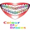 Colour My Braces