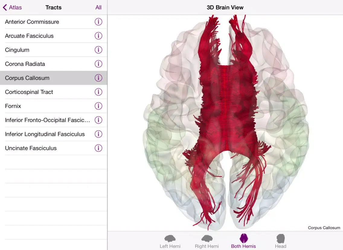 Brain Tutor HD iPad  স্ক্রিনশট