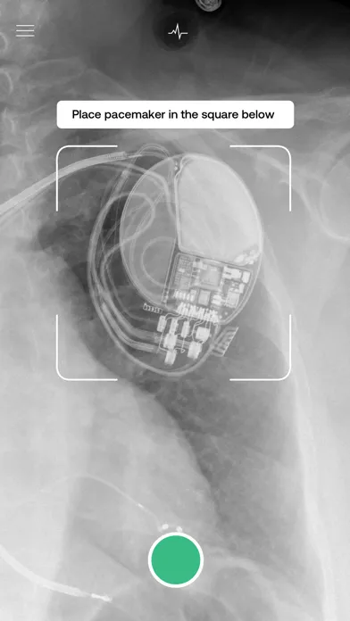 Pacemaker-ID应用截图