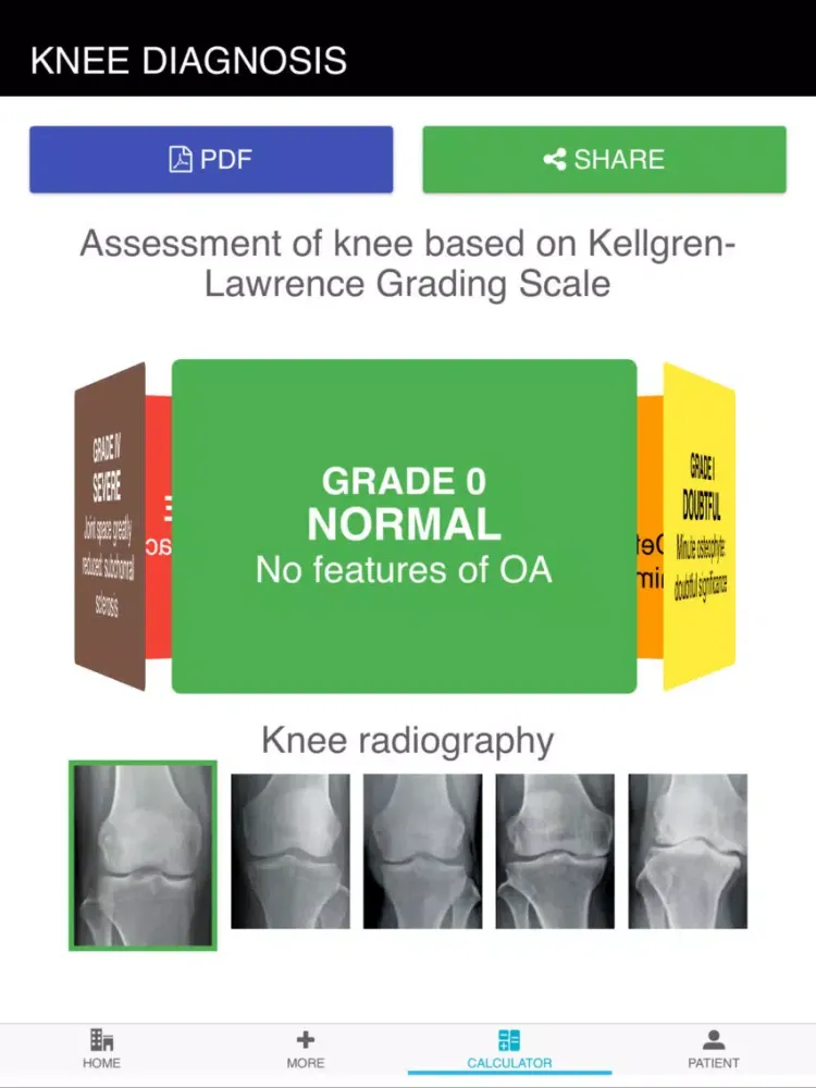 Doctor Support Osteoarthritis iPad  سکرین شاٹس