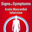 Signs & Symptoms Acute Myocardial Infarction