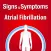 Signs & Symptoms Atrial Fibrillation