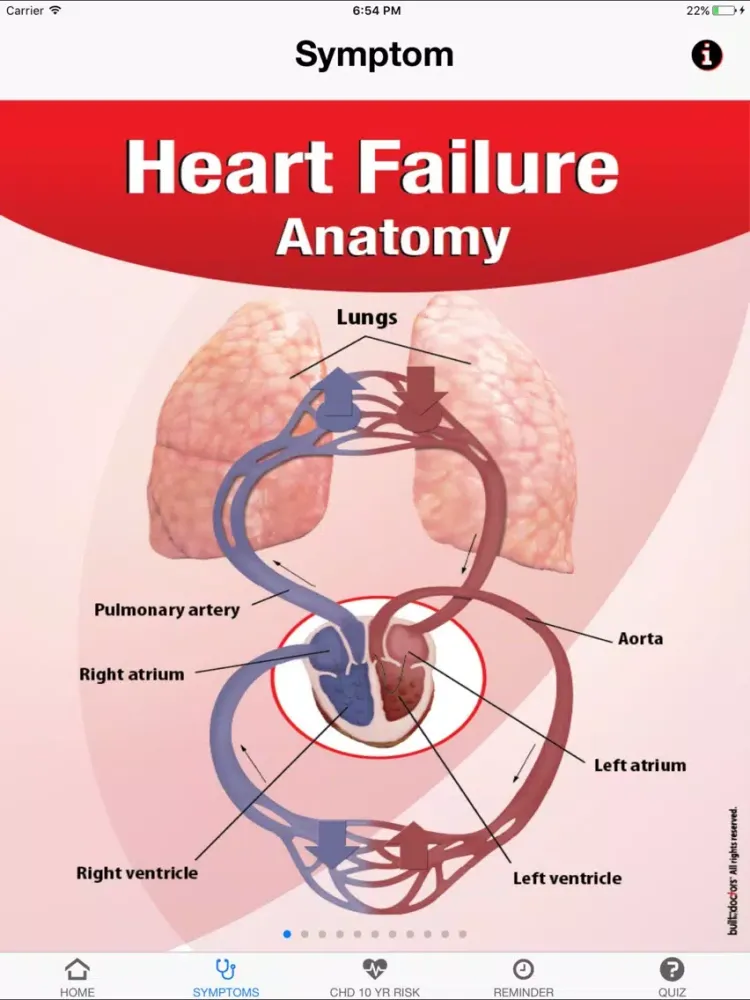 Signs & Symptoms Heart Attack iPad Screenshots