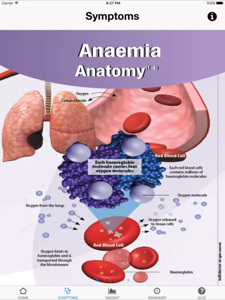 Signs & Symptoms Anaemia iPad Screenshots