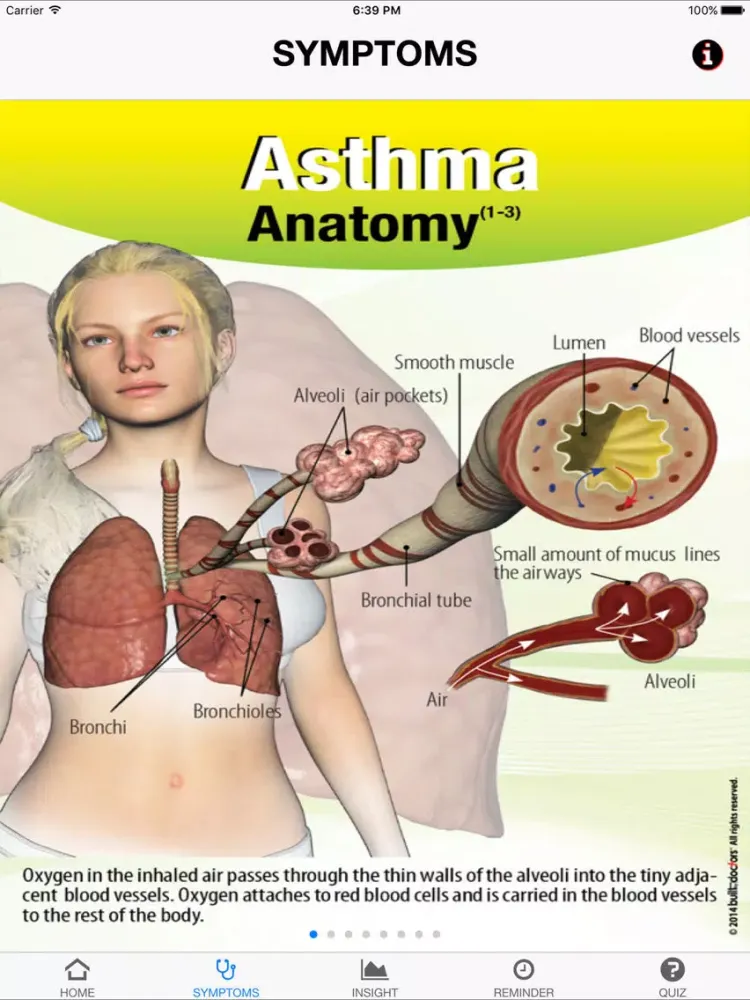 Signs & Symptoms Asthma iPad  Screenshots
