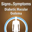 Signs & Symptoms Diabetic Malucar Oedema