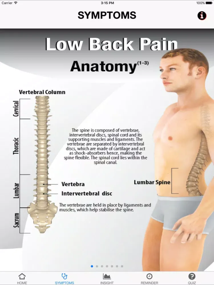 Signs & Symptoms Low Back Pain iPad 应用截图