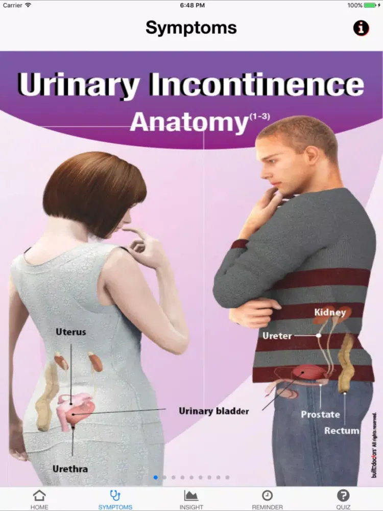 Capturas de tela do Signs & Symptoms Urinay Incontinence iPad 