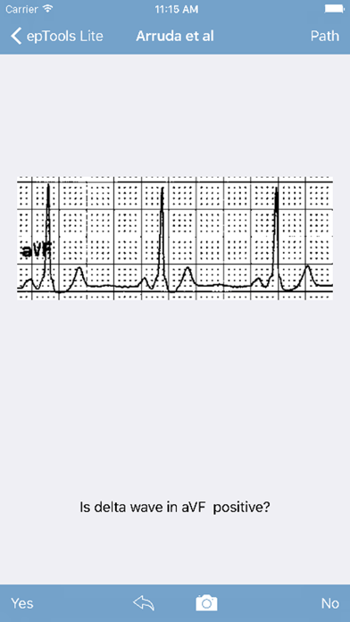 epTools Lite স্ক্রিনশট