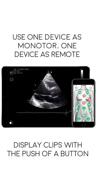 Awesome Ultrasound Simulator Ekran Görüntüleri