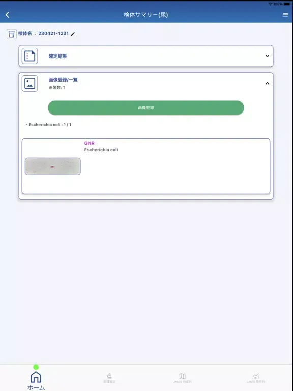 BiTTE (CarbGeM) iPad 应用截图