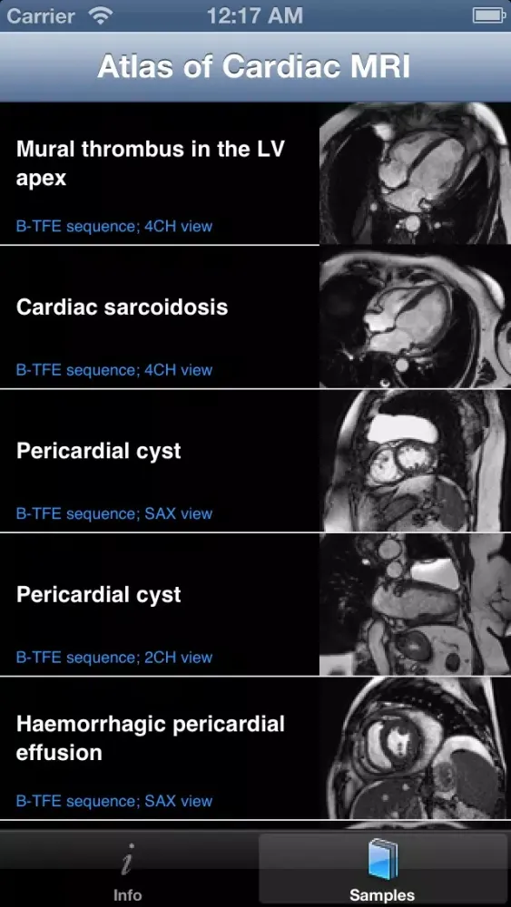 CARDIO3® Atlas of Cardiovascular Magnetic Resonance スクリーンショット