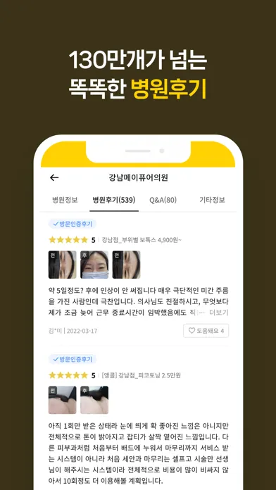 صور 캐시닥 - 병원 후기, 예약, 시술 최저가를 한눈에